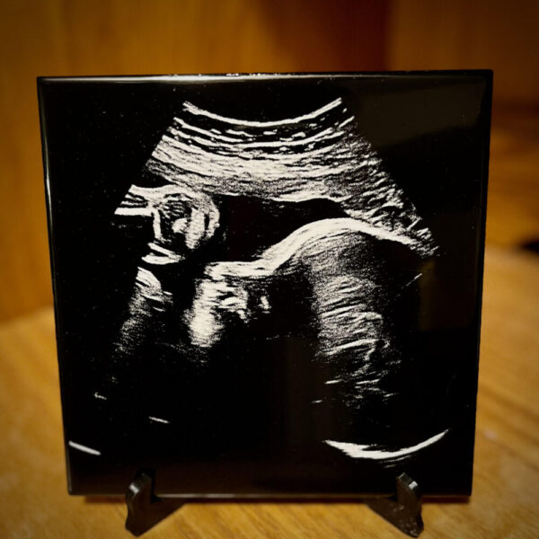 Ultrasound Keepsake, 2D/3D Sonogram Engraved on Tile