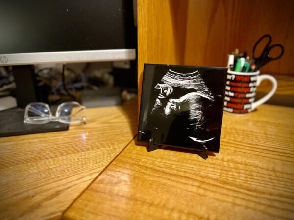 Ultrasound Keepsake, 2D/3D Sonogram Engraved on Tile