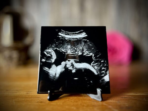 Ultrasound Keepsake, 2D/3D Sonogram Engraved on Tile