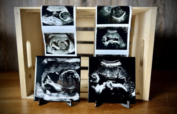 Ultrasound Keepsake, 2D/3D Sonogram Engraved on Tile